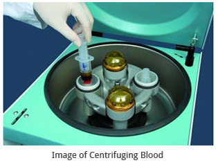 Image of Centrifuging Blood
